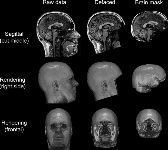 brain_anonymizer