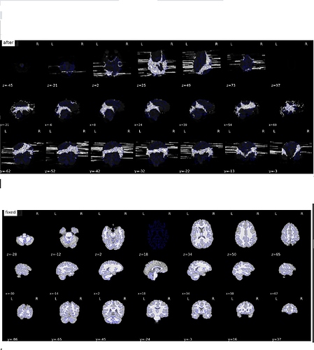 top_fmriprep-with-fm-sdc-after-below_withoutfm-fixed