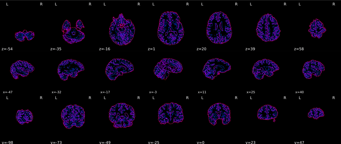 sub-05_acq-conventional_T1w_seg_brainmask