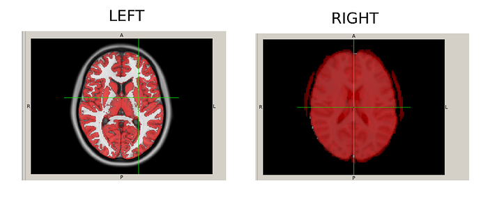 t1_and_t2_preprop