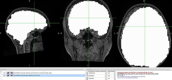 T1w_and_brainmask