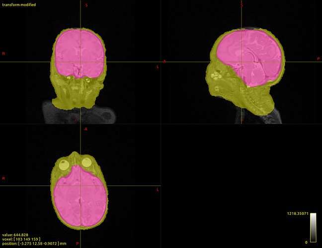 dhcp-structural-pipeline_-_T2_with_brain_masks0000