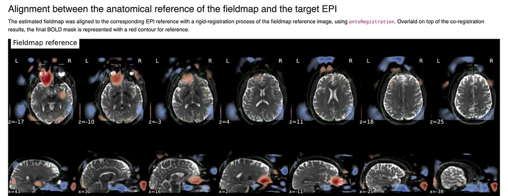 Poor Fieldmap Functional Registration in fMRIPrep (highly variable step ...