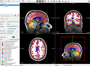 reconAllClinicalOutput