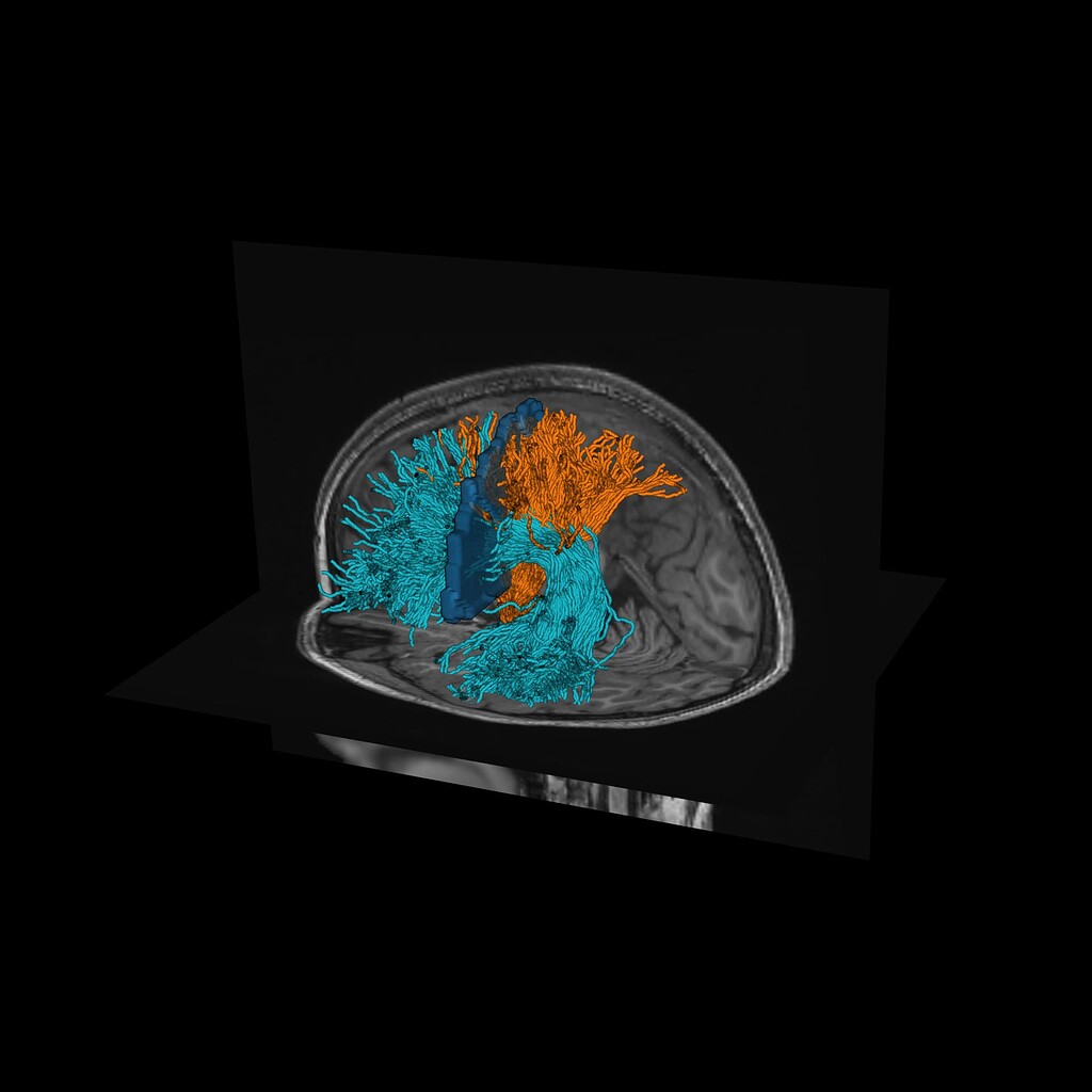 How to show streamlines from mrtrix3 in DIPY with an orientation color ...