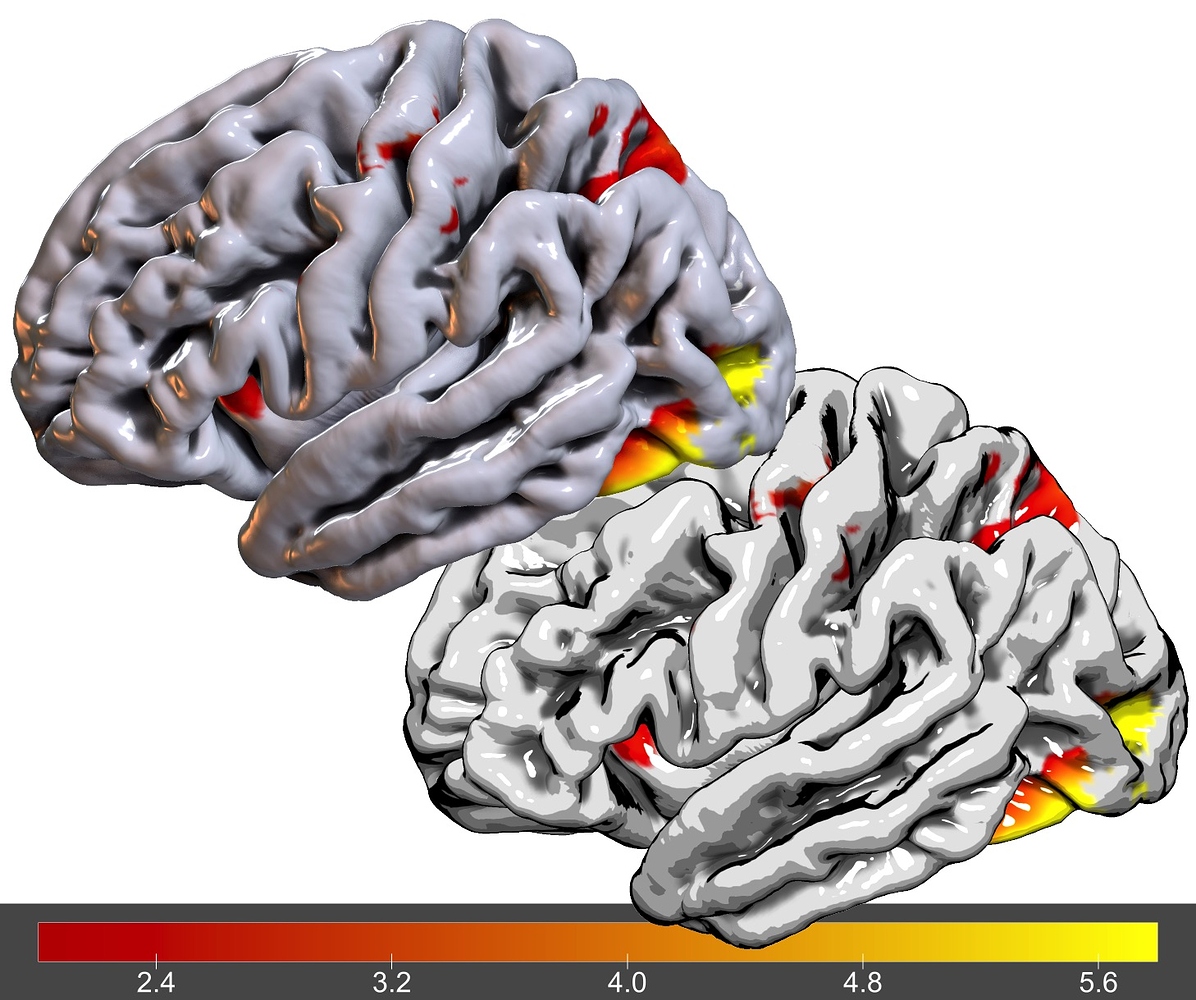 Displaying surface files generated by neurovault - neurovault - Neurostars