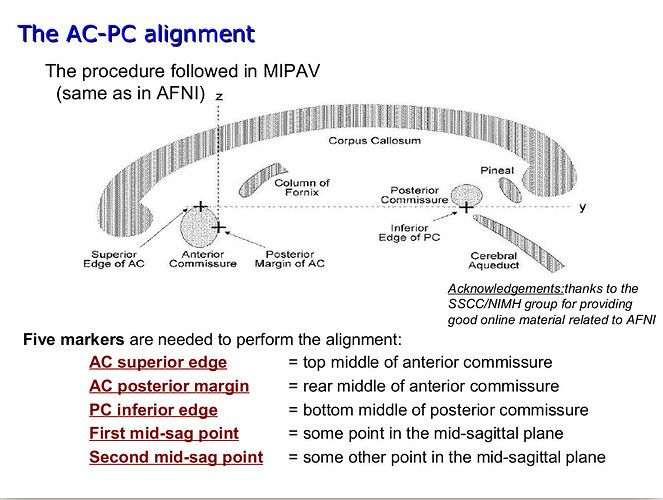 ACPC alignment