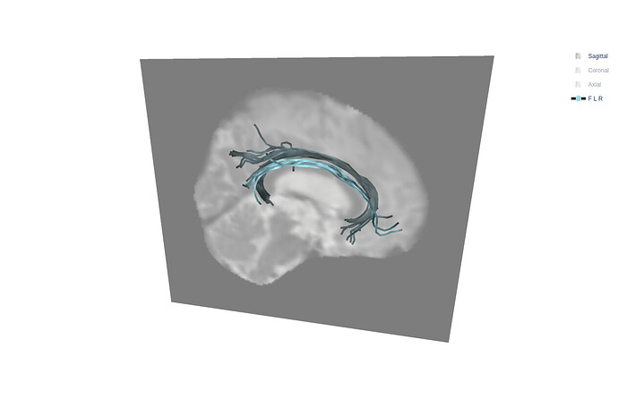 Example Tractography