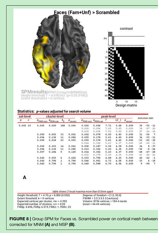 How to render the statistic results of EEG source-reconstructed maps ...