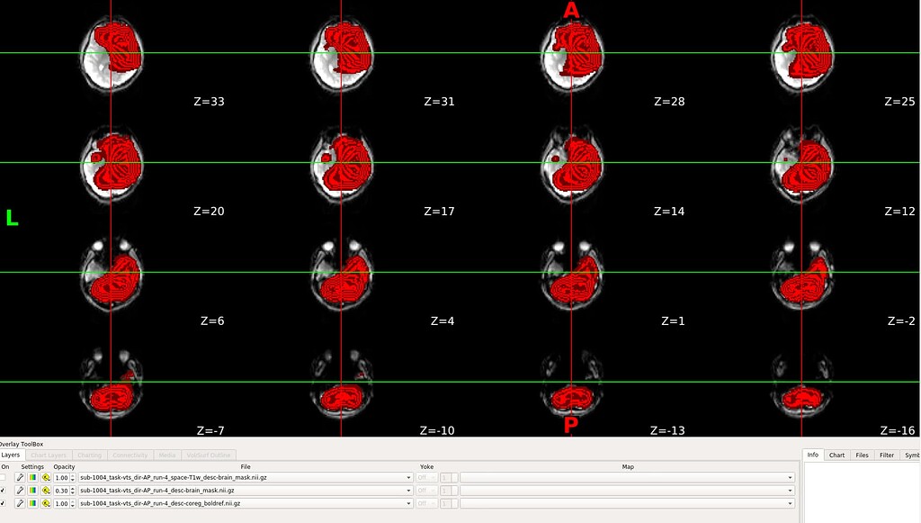 Brain Mask In Python Brain mask distorted causing registration issues - fmriprep - Neurostars
