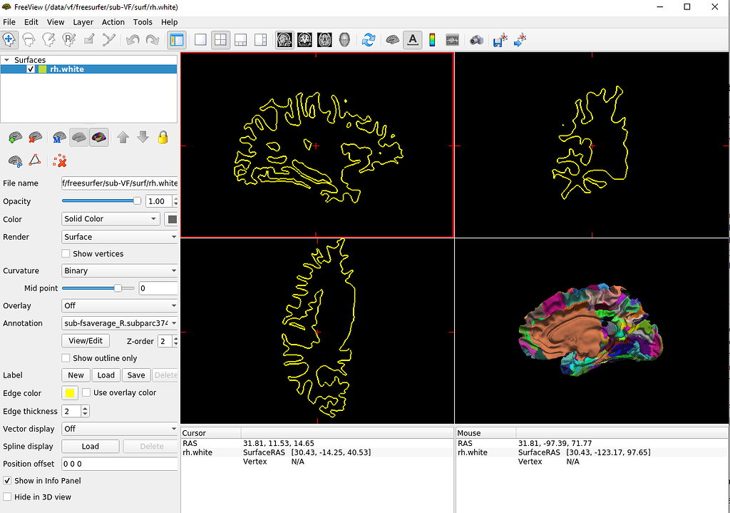 fsLR atlas ( .label.nii) to Freesurfer subject space - Software Support ...