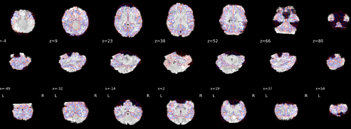 Alignment_functional_anat_MRI_data