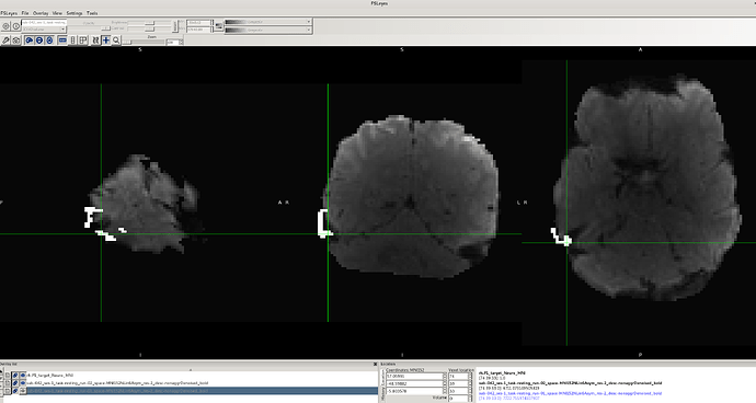 after fmri post aroma