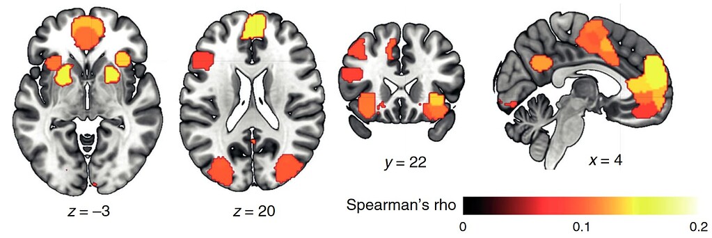 How to get high resolution activation map in nilearn - neuroimaging ...