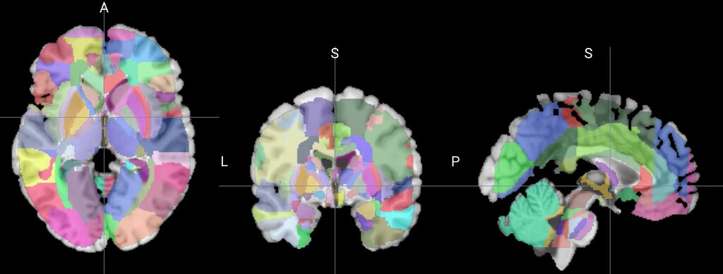 田仲真治「Brain Update」 sddefault.jpg