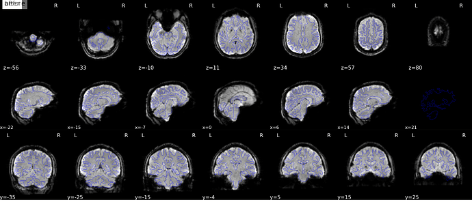 neurostars%20help