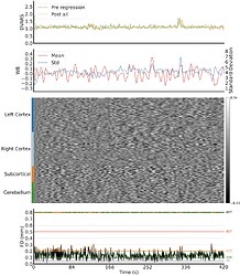 sub-CMH0029_ses-01_task-rest_run-01_space-fsLR_desc-postprocESQC_bold
