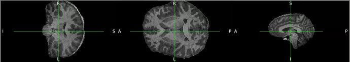 doubt_antsBrainExtraction