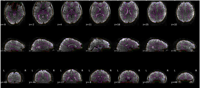 fmriprep_brain mask