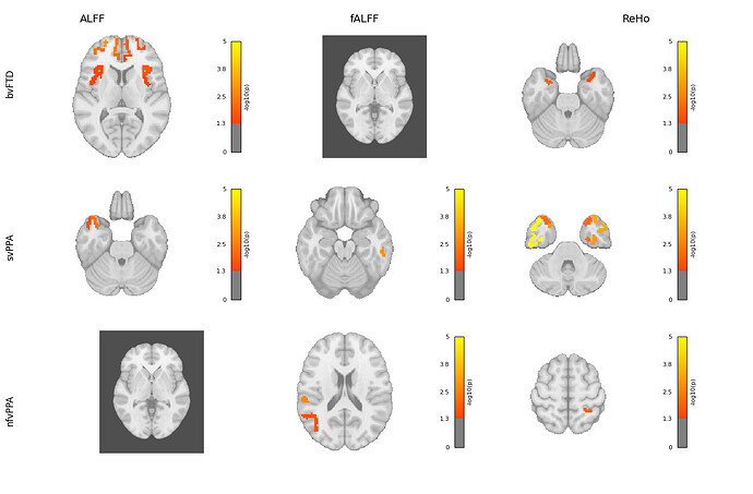 brain