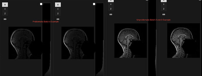 Problem T1 NIfTI vs. Typical T1 from earlier batches