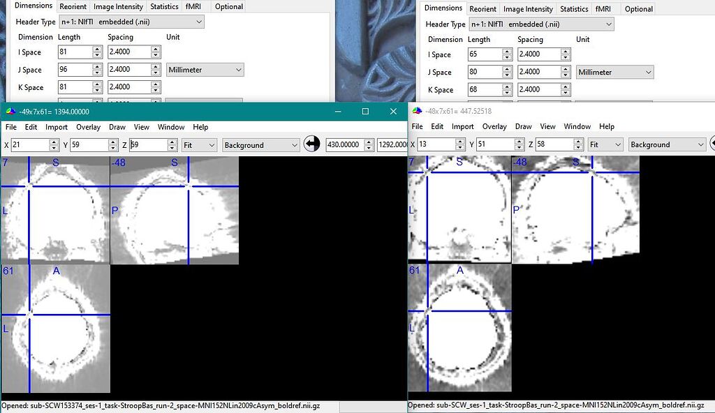 fMRIPrep 25.1.0: possible to increase output bounding box? - Software ...