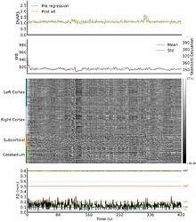 sub-CMH0029_ses-01_task-rest_run-01_space-fsLR_desc-preprocESQC_bold