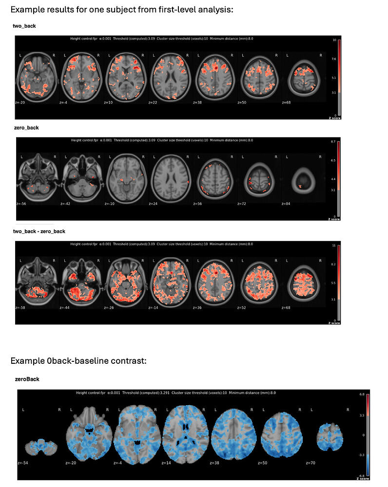 Unexpected deactivation in 0back-baseline nback task contrast group ...