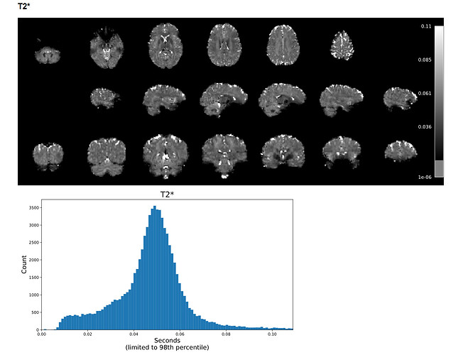 tedana_24.0.1_example_A_html_report_t2star