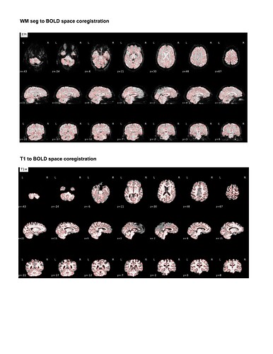 BOLD_T1_coreg