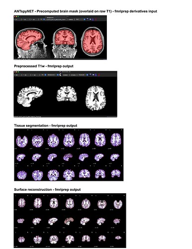 fmriprep_precomputed_brain_mask_issue