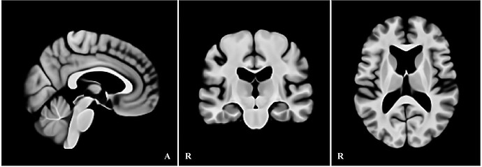 Elderly Brain Template