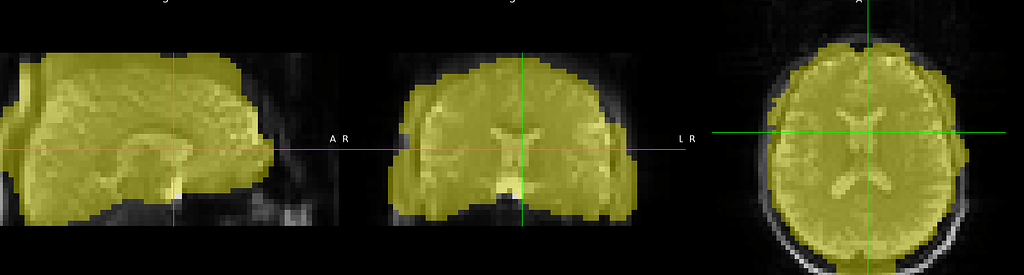 Brain Mask In Python Weird brain mask from ASLPrep - Software Support - Neurostars