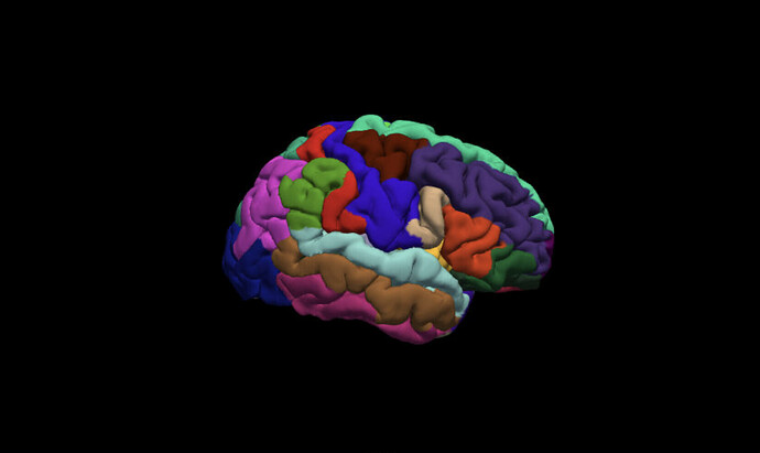 Incorrect parcellation of RH