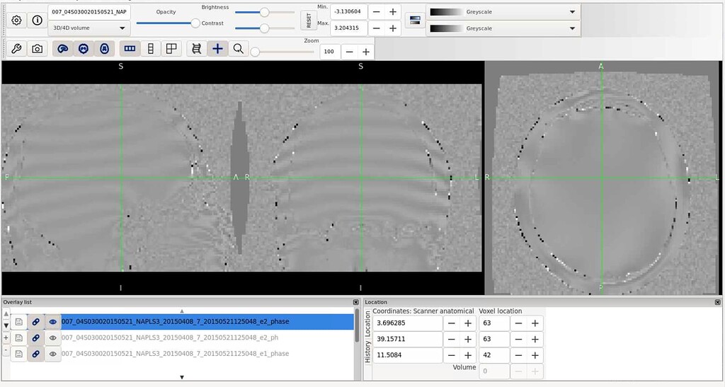 NAPLS3 Gradient Echo Phase Fieldmaps - Software Support - Neurostars