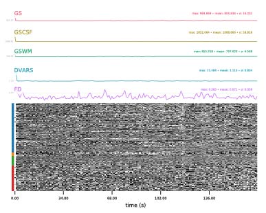 PST_TRAIN_run-2_bold_carpetplot