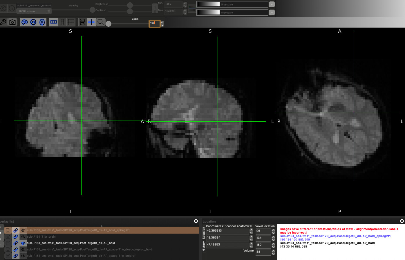 Passing Pre-Registered fMRI Images to fmriprep - Software Support ...