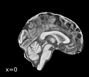 Screenshot 2025-11-02 at 2.55.24 PM